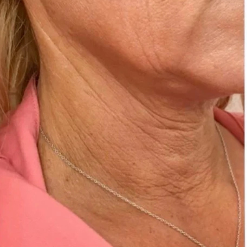 image comparison before