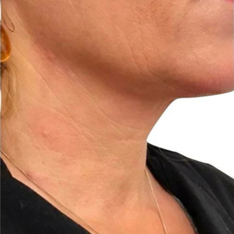image comparison after